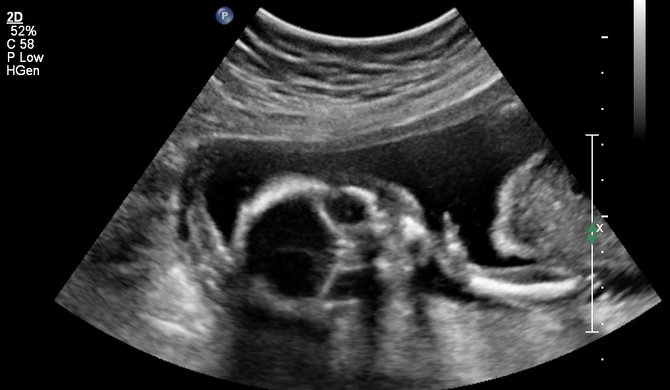 Flikr photo of ultrasound by Parker Michael Knight